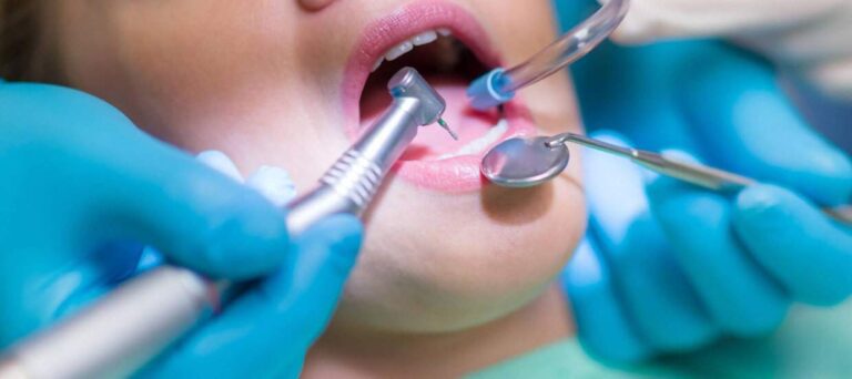 Oralni kirurg: 6 situacija kada je neophodan oralni kirurg
